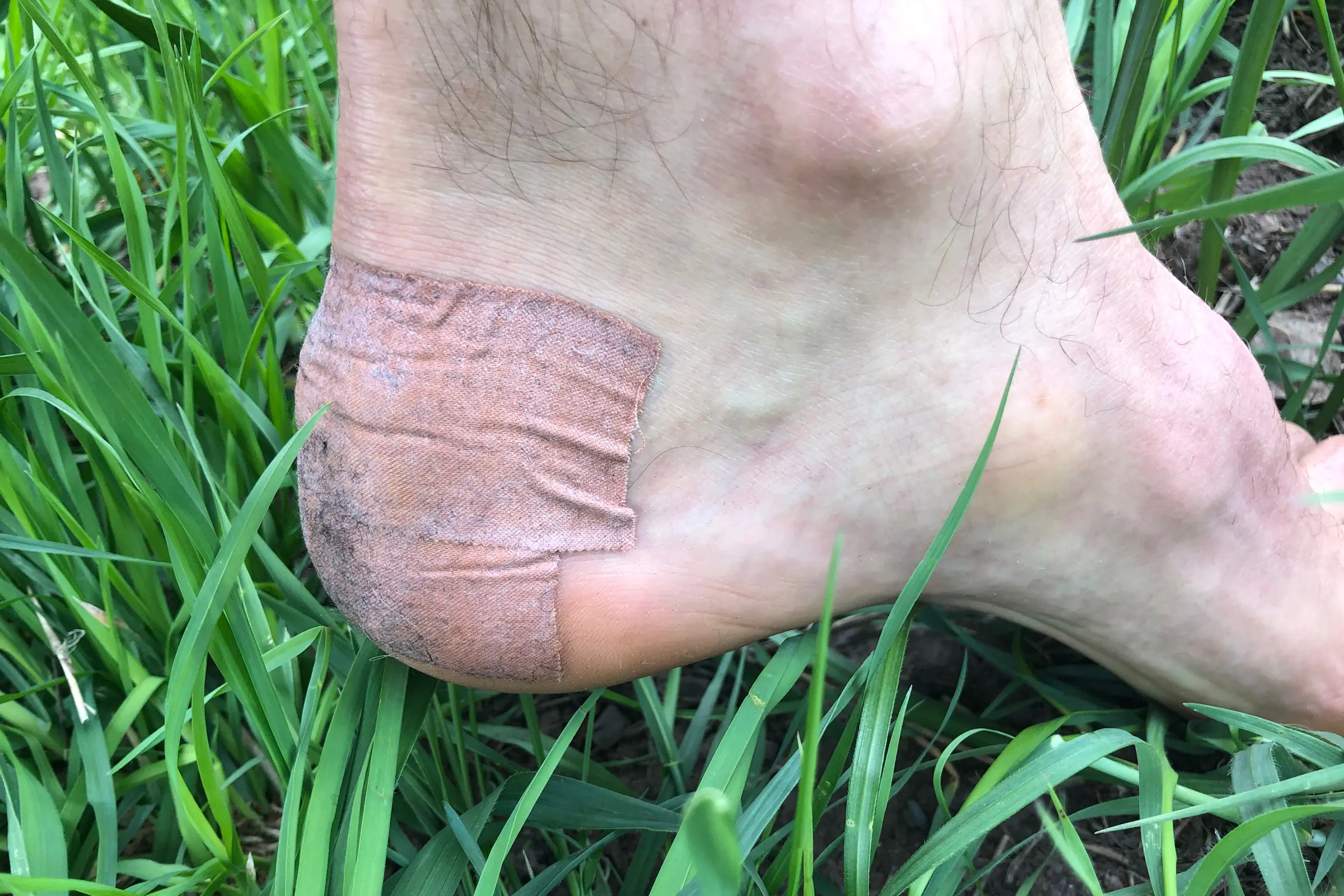 Using Leukotape to prevent a friction blister; (photo/Bergen Tjossem)