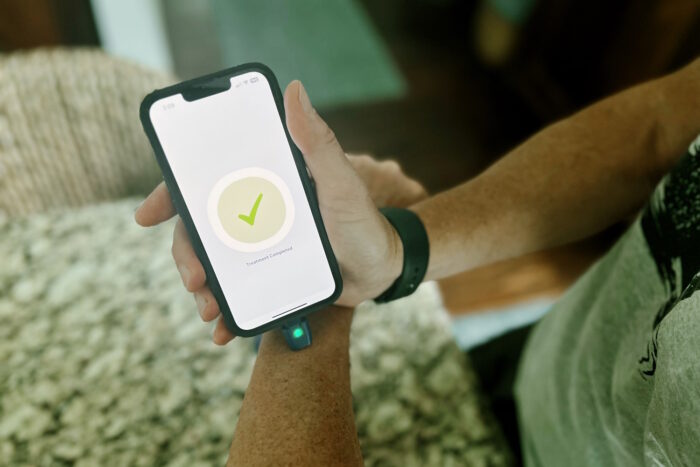 insect bite treatment device