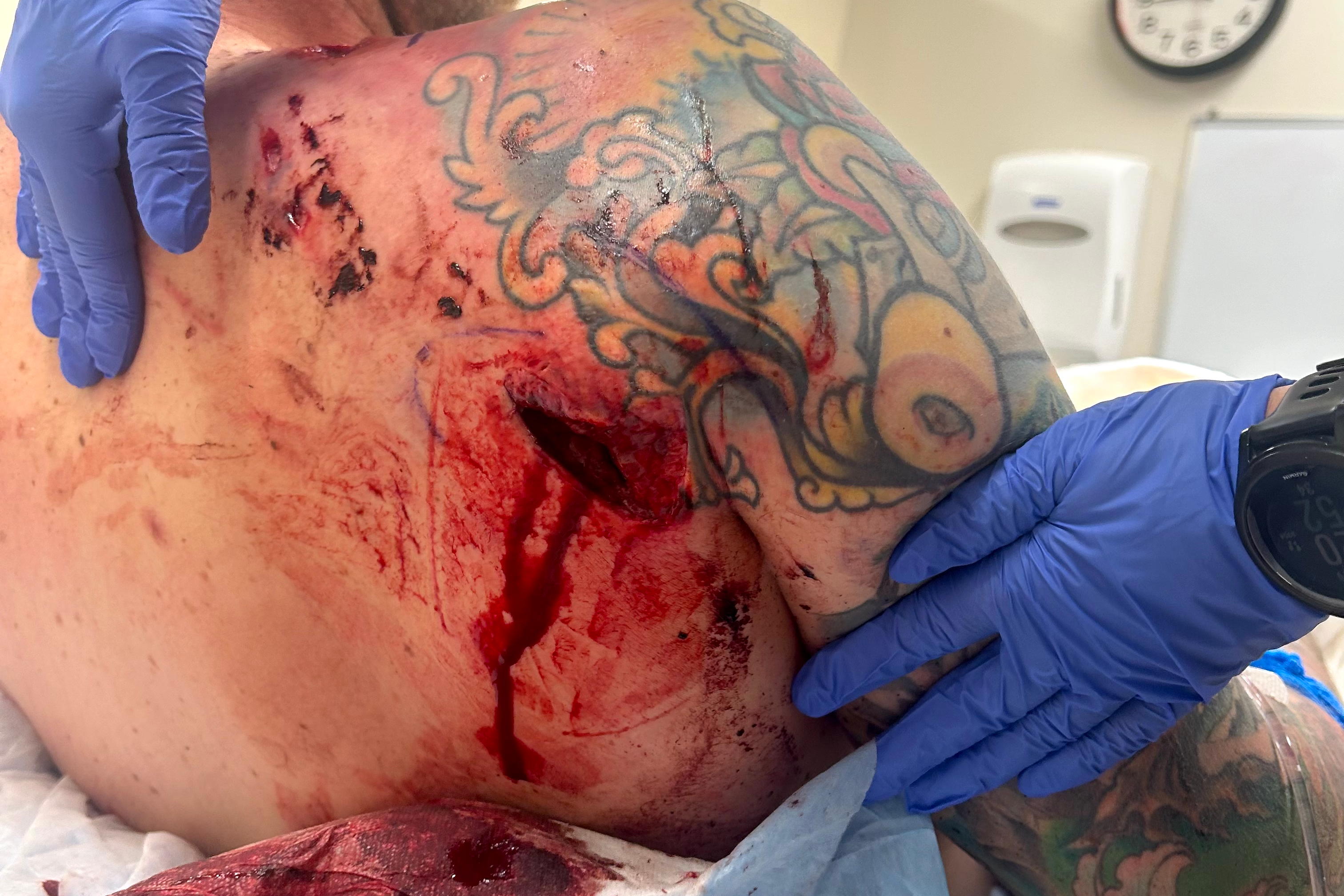 grizzly bear attack shayne patrick teton national park wyoming