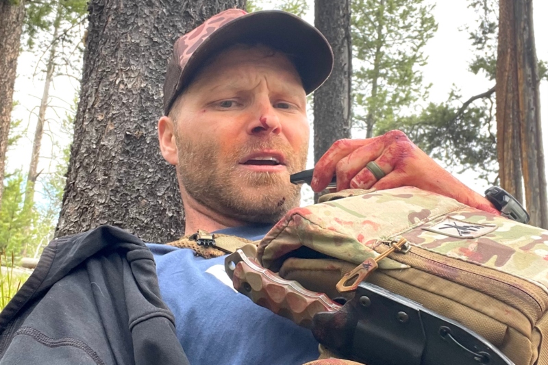 ‘It Was Pure Violence’: Grizzly Attack Survivor Recounts Horrifying Encounter and the Decisions That Saved Him