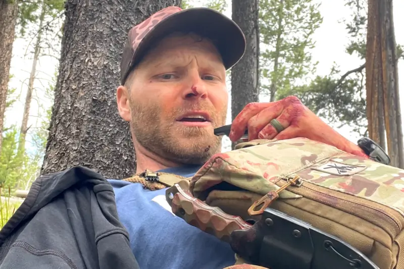 ‘It Was Pure Violence’: Grizzly Attack Survivor Recounts Horrifying Encounter and the Decisions That Saved Him