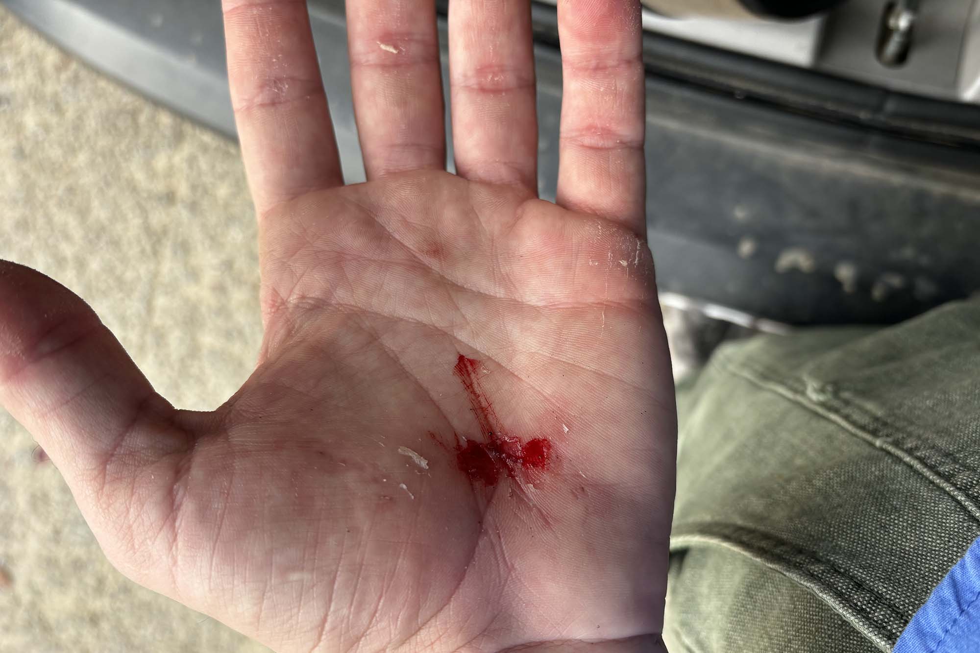 onewheel pint s injury