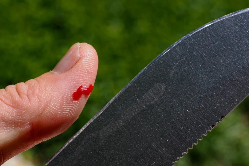 Cut thumb and saddle mountain skinner