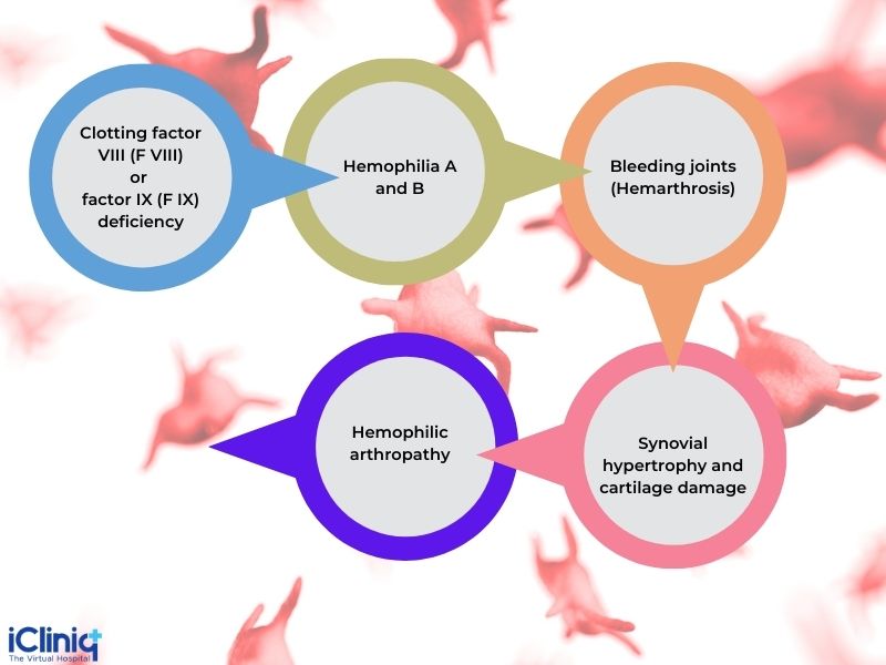 What Is Hemophilic Arthropathy?