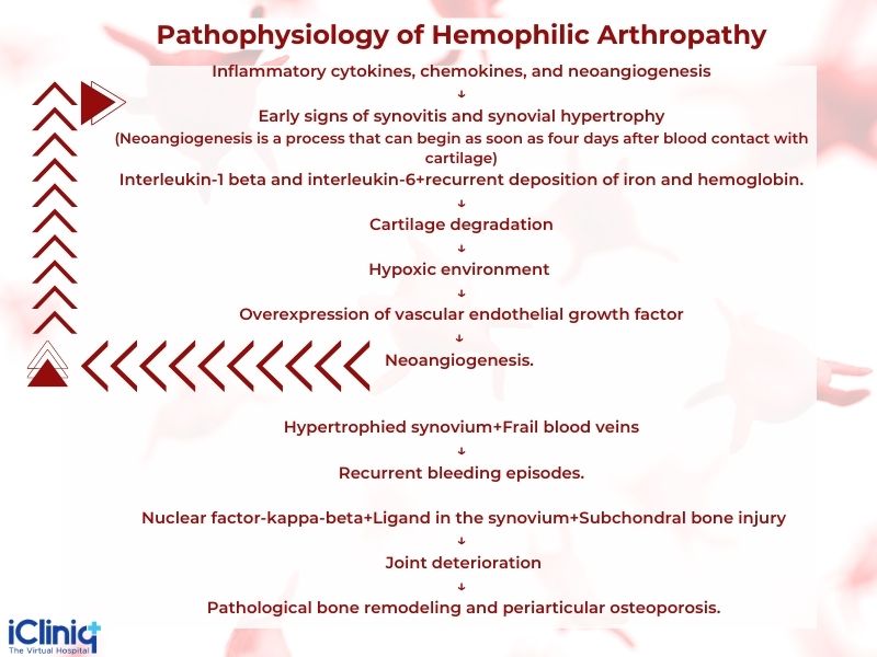 What Is Hemophilic Arthropathy?