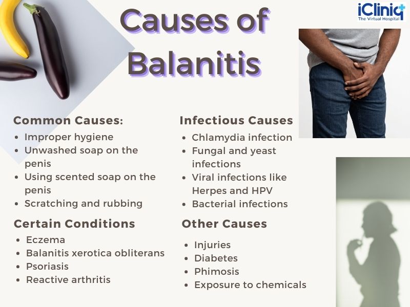 ¿Qué Es La Balanitis? | Balanopostitis: Qué Es, Causas, Síntomas y ...