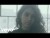 Alessia Cara 'Scars To Your Beautiful' music video