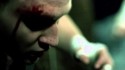 Heart Of A Coward 'Deadweight' Music Video