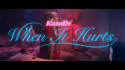 Kandle 'When It Hurts' Music Video
