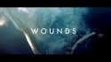 Ulysse 'Wounds' Music Video