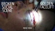 Broken Social Scene 'Golden Facelift' music video