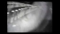 Mother Love Bone 'Stardog Champion' Music Video