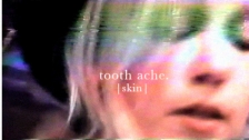 Tooth Ache 'Skin' music video