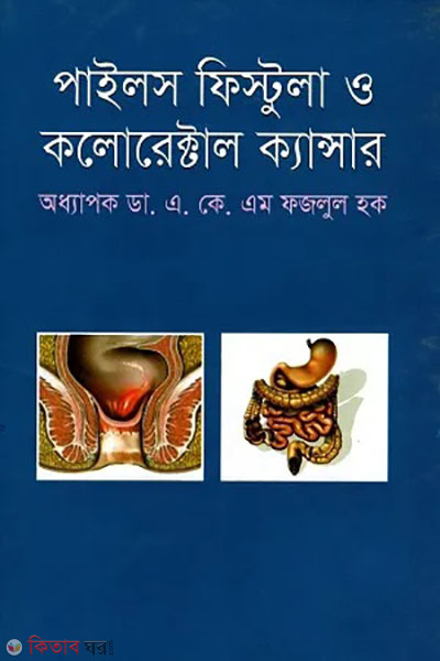 Piles fistula and colorectal cancer (পাইলস ফিস্টুলা ও কলোরেক্টাল ক্যান্সার)