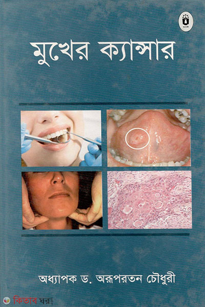 mukher cancer (মুখের ক্যান্সার)