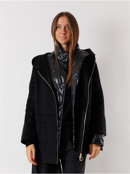  HOX | XD6319WO20 CARBON