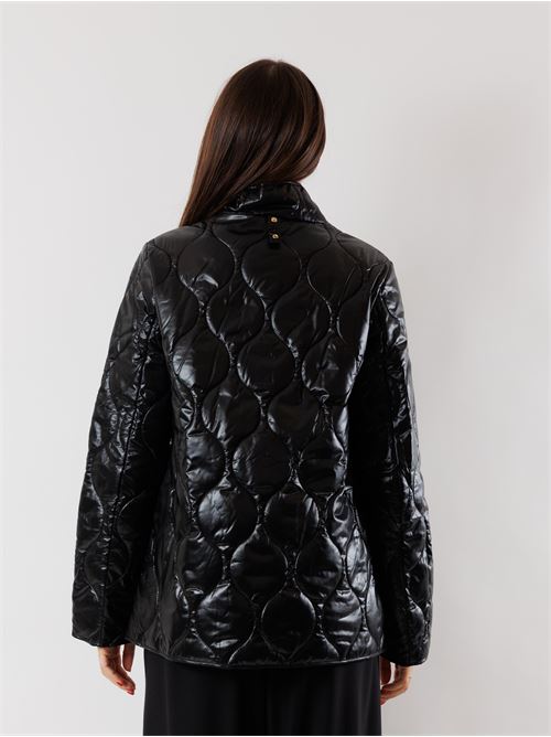  HOX | XD6319WO20 CARBON