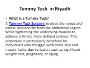 Tummy Tuck in Riyadh (1)