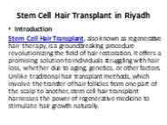 Stem Cell Hair Transplant in Riyadh