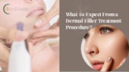 What to Expect From a Dermal Filler Treatment Procedure?
