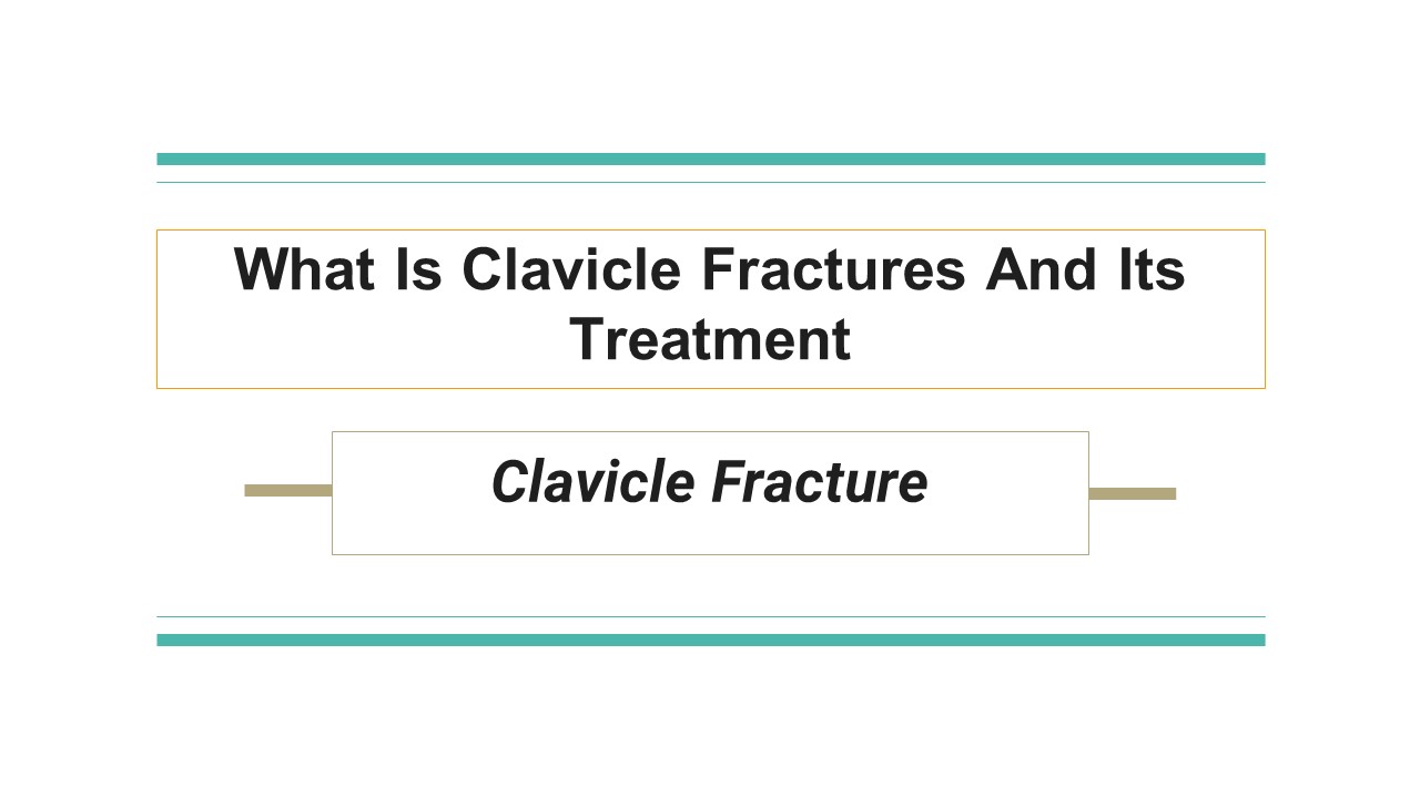 What Is Clavicle Fractures And Its Treatment