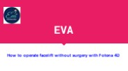 Facelift without surgery