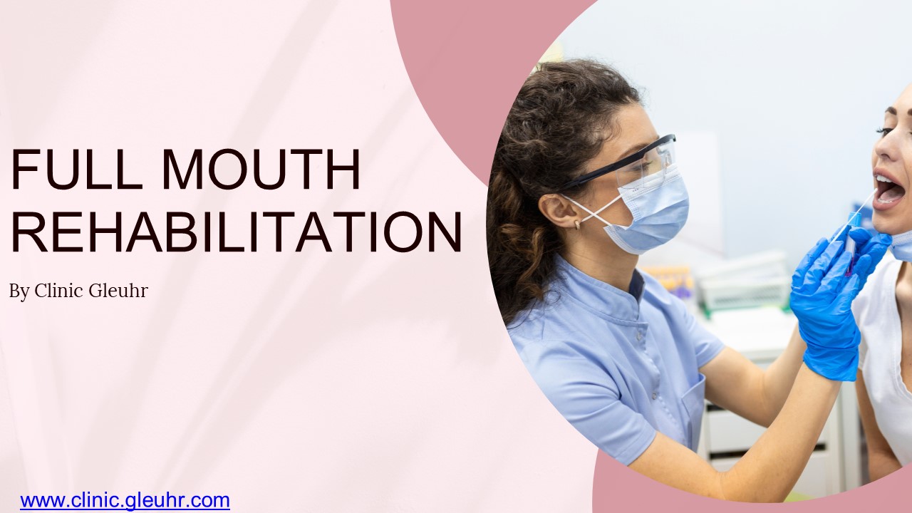 What is FULL MOUTH REHABILITATION?