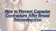 How to Prevent Capsular Contracture After Breast Reconstruction