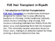 FUE Hair Transplant in Riyadh