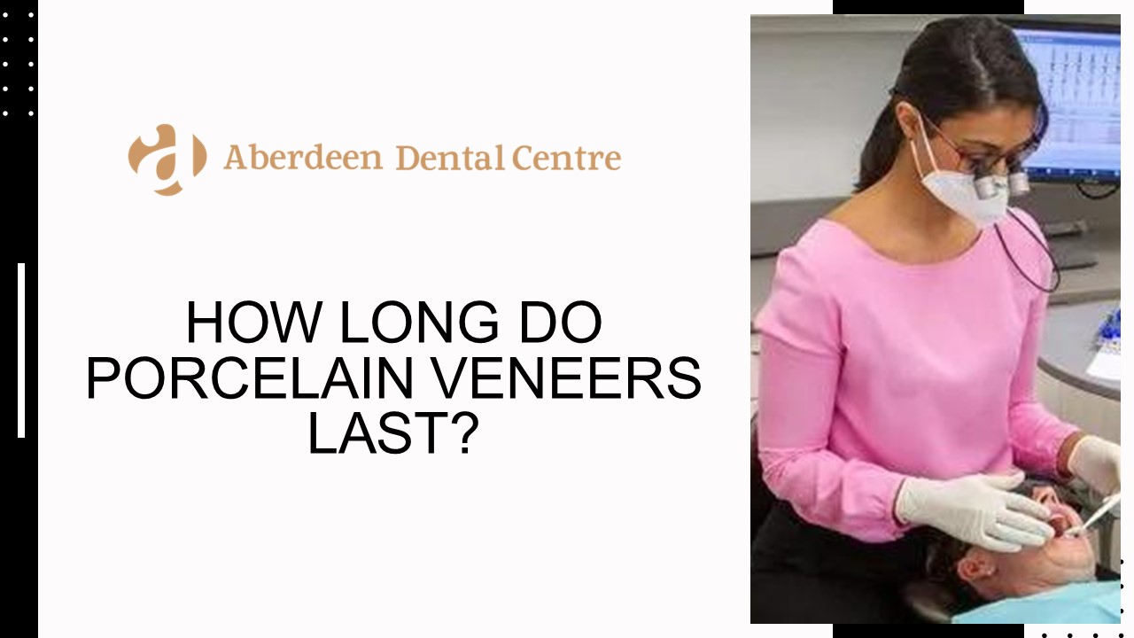How long do Porcelain Veneers last