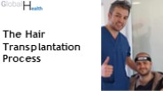 Transform Your Appearance with Hair Transplantation in Turkey