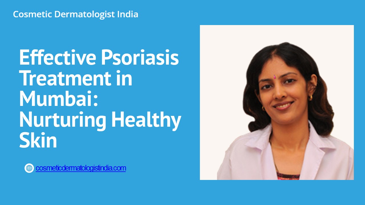 Effective Psoriasis Treatment in Mumbai: Nurturing Healthy Skin