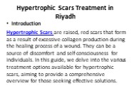 Hypertrophic Scars Treatment in Riyadh