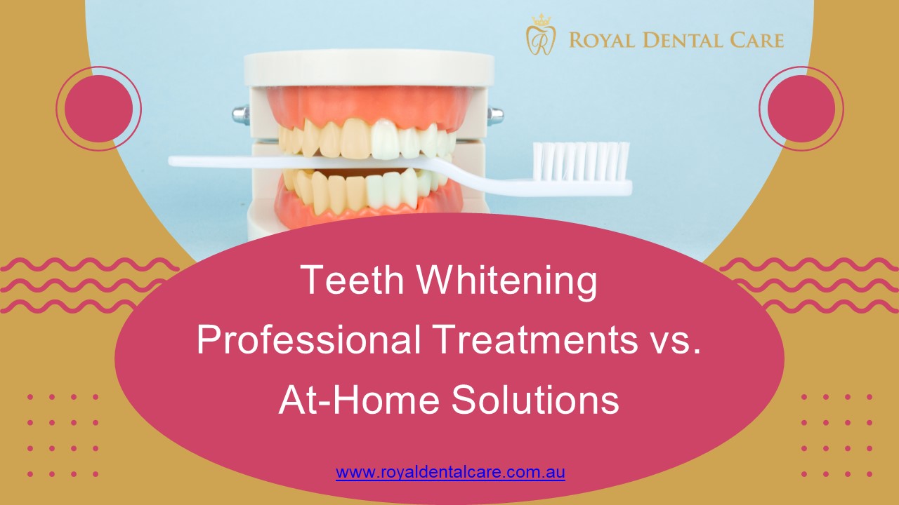 Teeth Whitening: Professional Treatments vs. At-Home Solutions