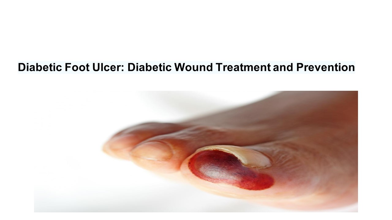 Diabetic Foot treatment India