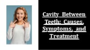 Cavity Between Teeth: Causes, Symptoms, and Treatment