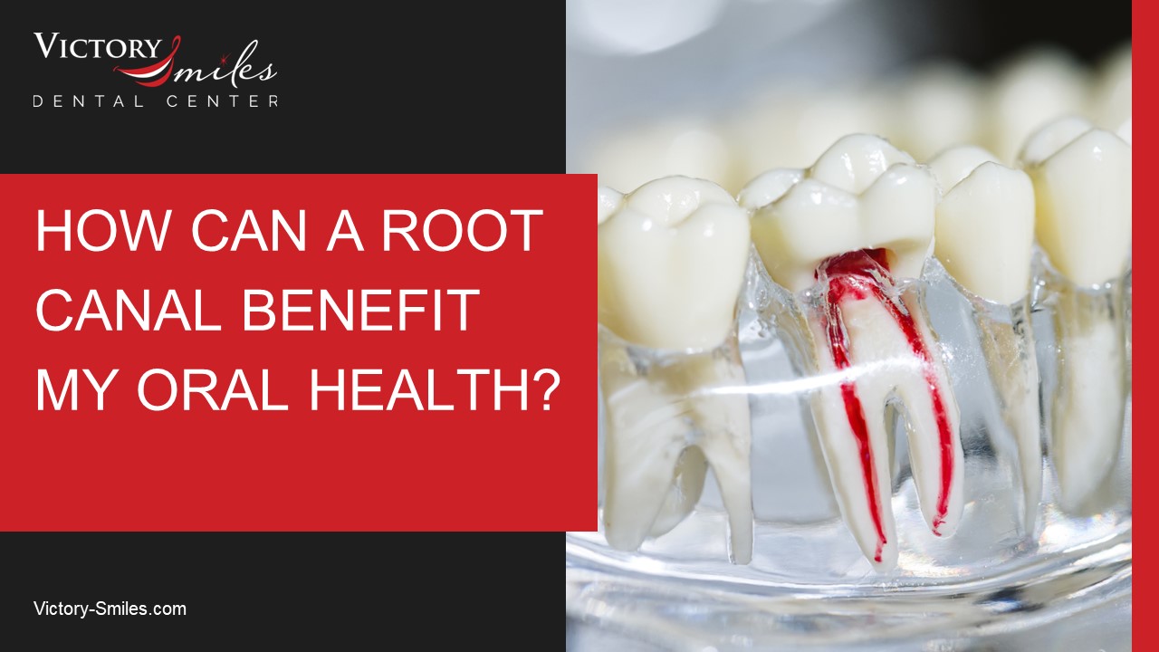 How Can a Root Canal Benefit My Oral Health?