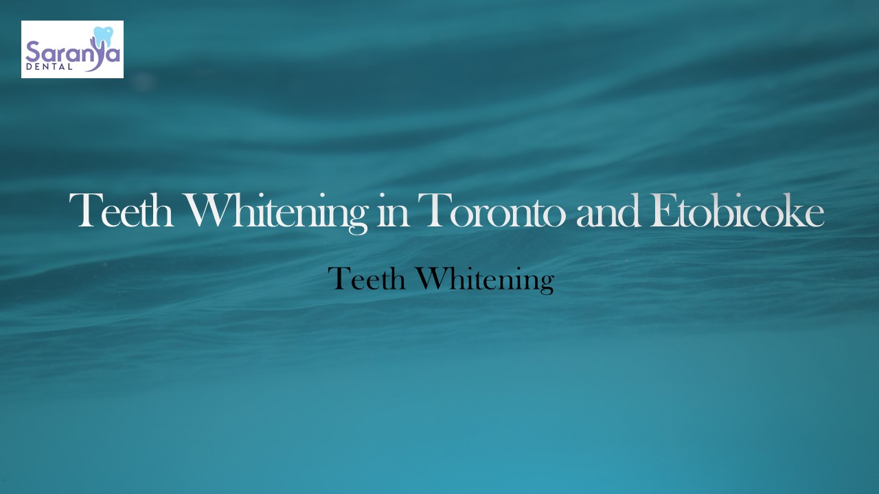 Teeth Whitening in Toronto | Teeth Whitening in Etobicoke