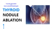 Thyroid Nodule Ablation