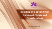 Deciding on a Second Hair Transplant: Timing and Considerations