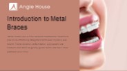 Introduction to Metal Braces