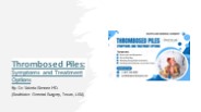 Thrombosed Piles: Symptoms and Treatment Options