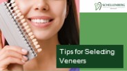 Tips for Selecting Veneers