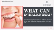 What Can Invisalign Treat?