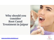 Root Canal Treatment in Jaipur: Your Path to Dental Wellness