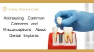Addressing Common Concerns and Misconceptions about Dental Implants