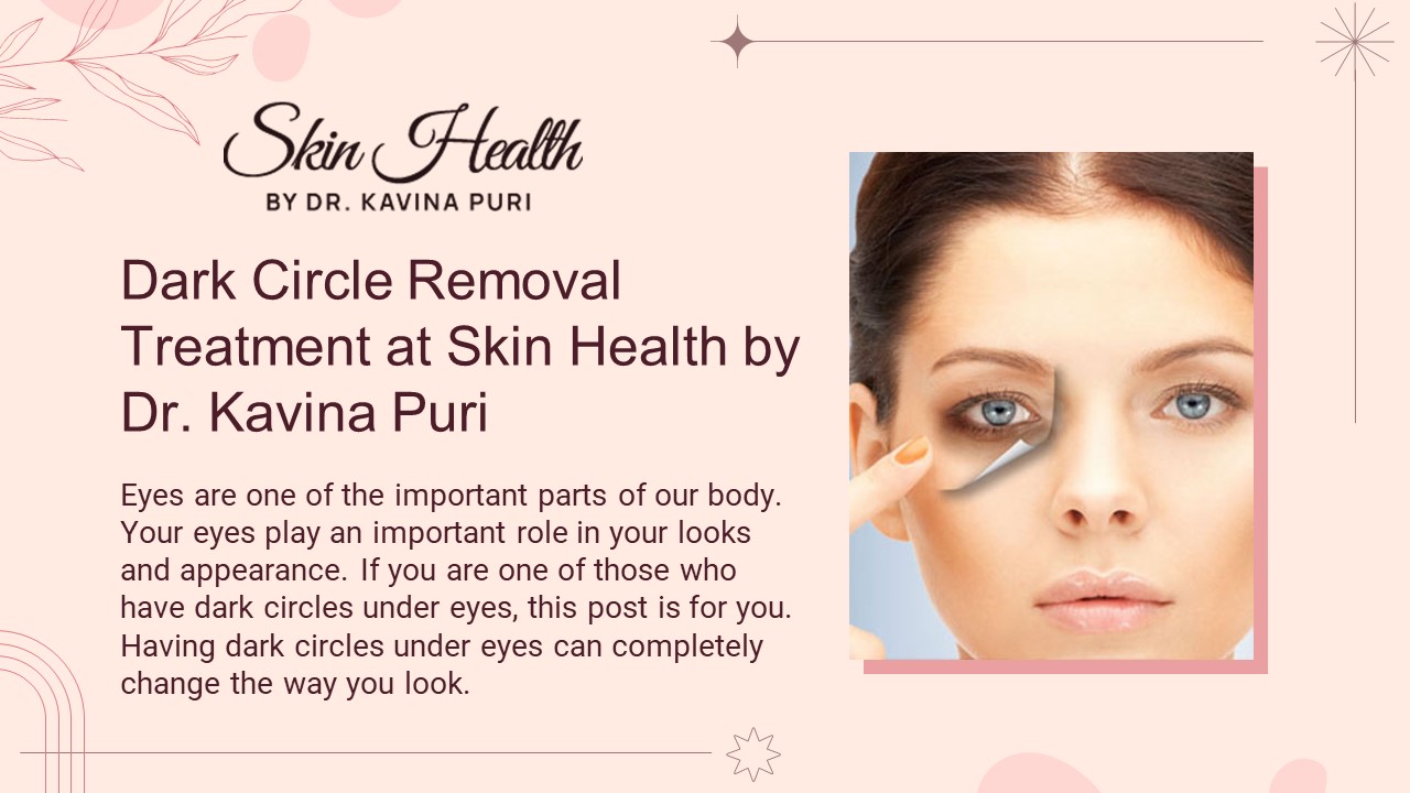Best Dermatologist for Dark Circles (1)