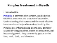 Pimples Treatment in Riyadh