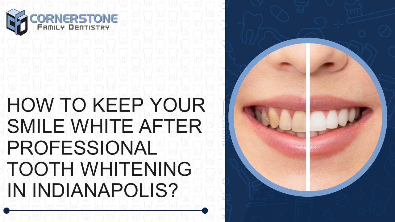 How to Keep Your Smile White After Professional Tooth Whitening in Indianapolis