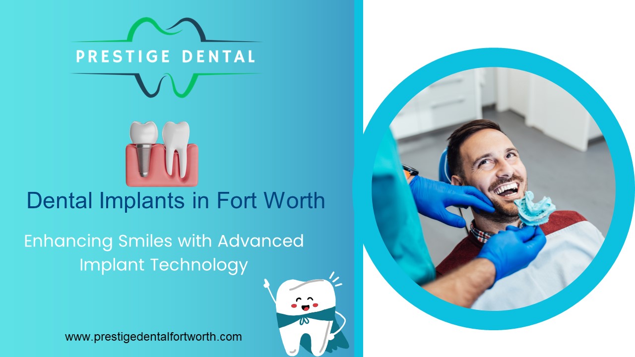 Dental Implants in Fort Worth